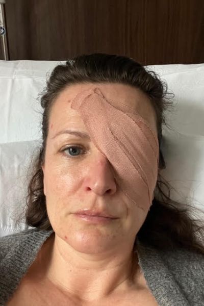 Tessa after her operation