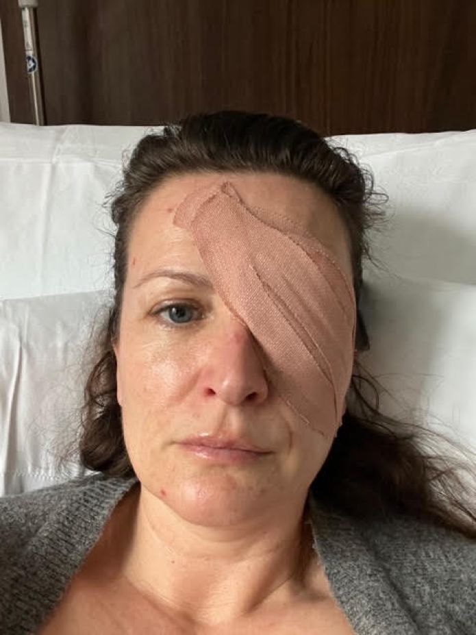 Tessa after her operation